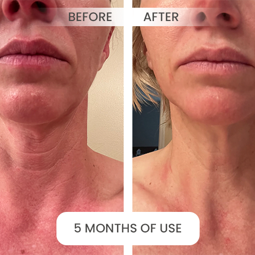 before-after4