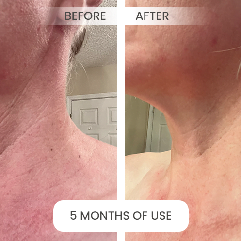 before-after5
