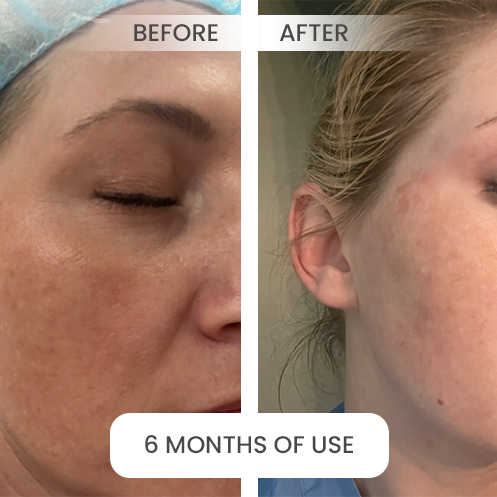 before-after7