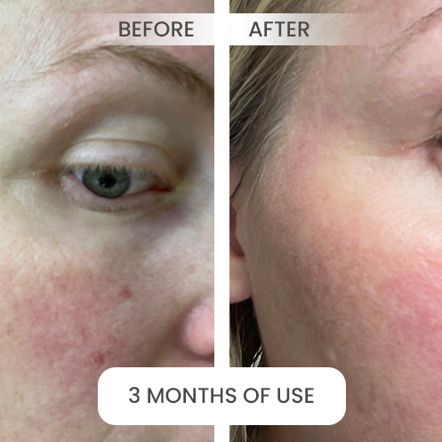 before-after8